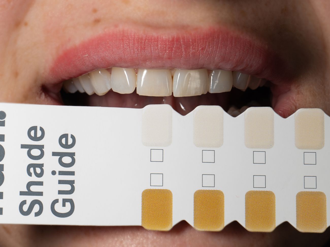 How to whiten your teeth