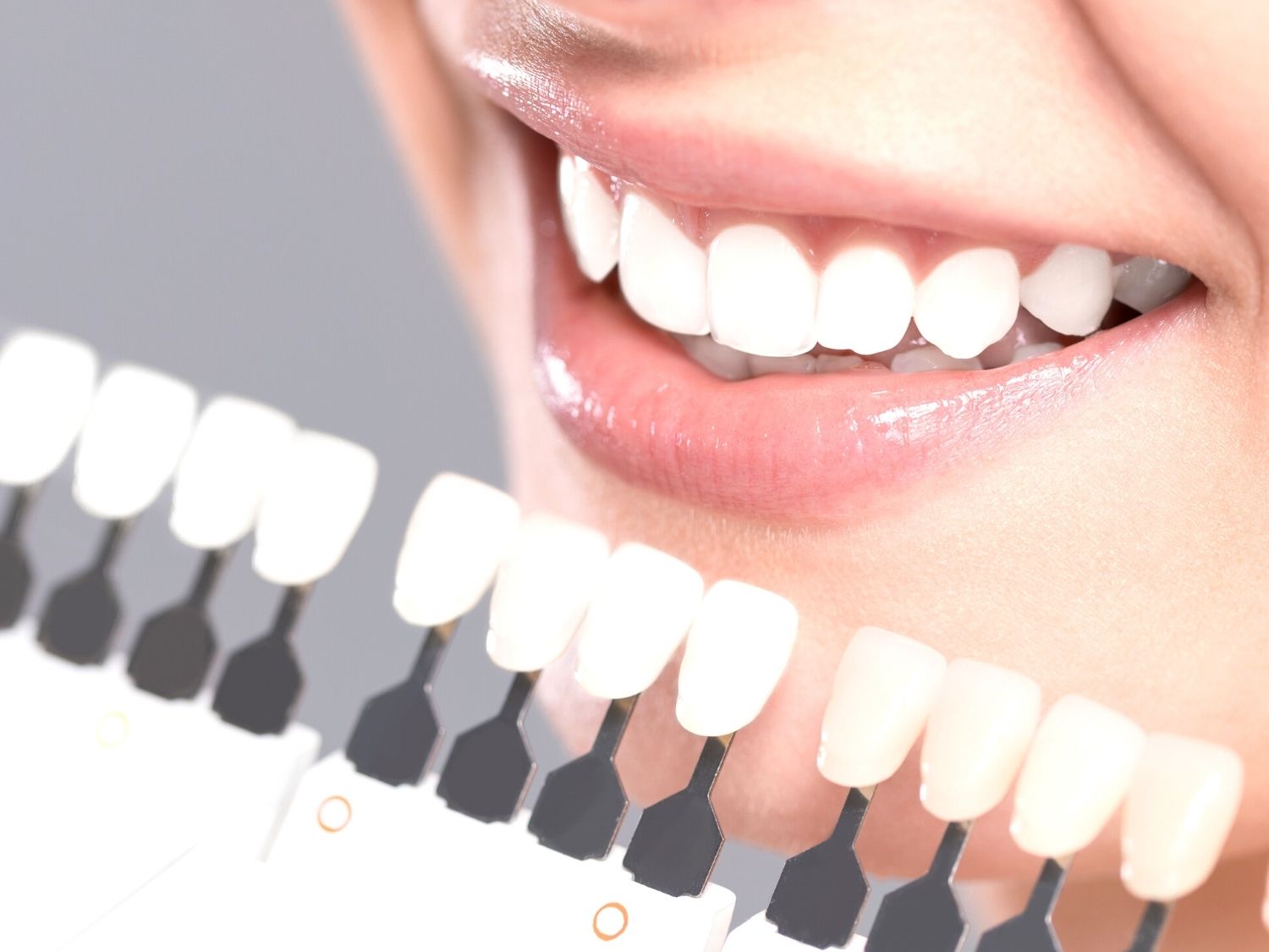 A lady smiling showing her white teeth.
