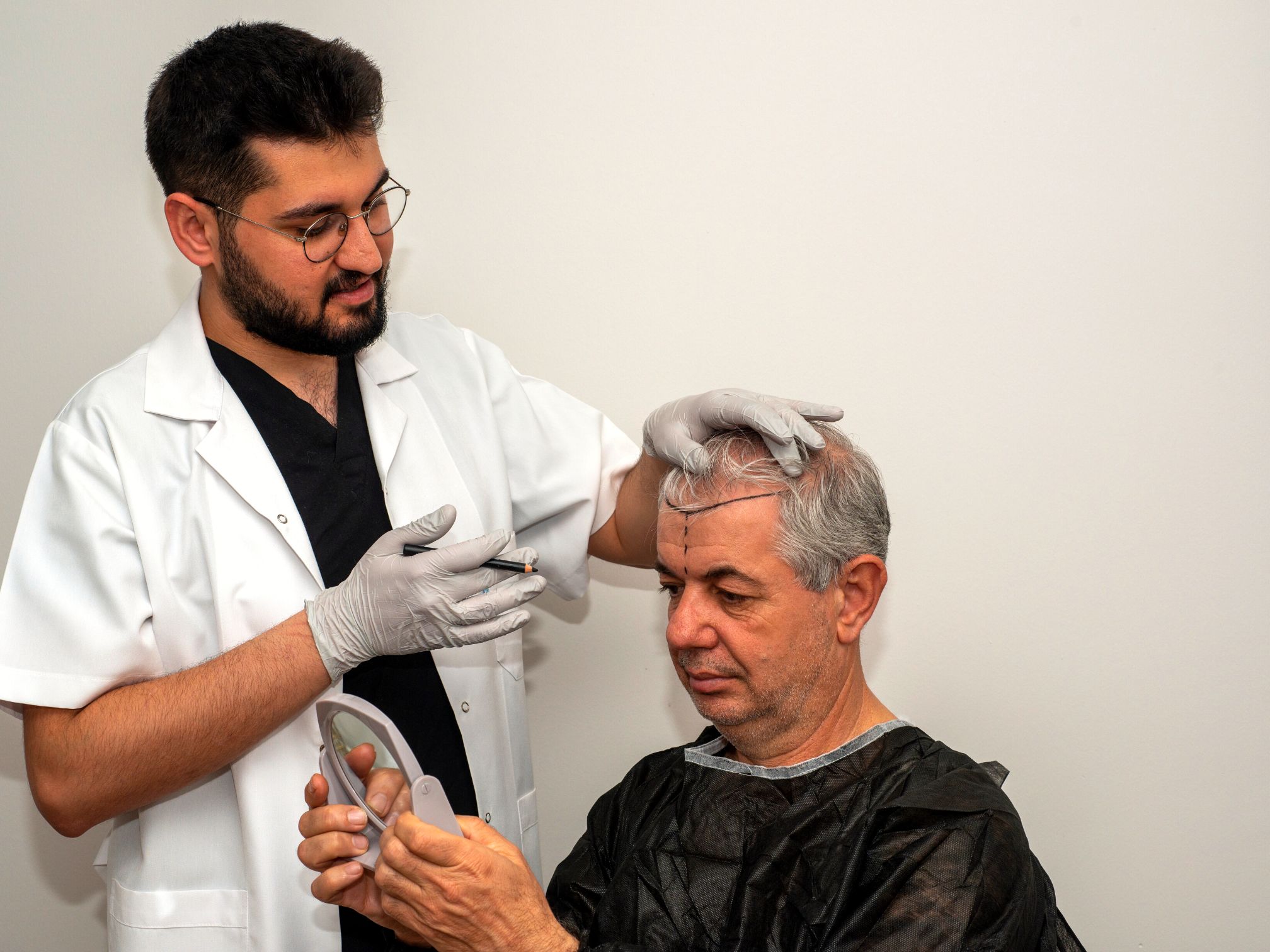 Common Misconceptions Surrounding Hair Transplant Procedures