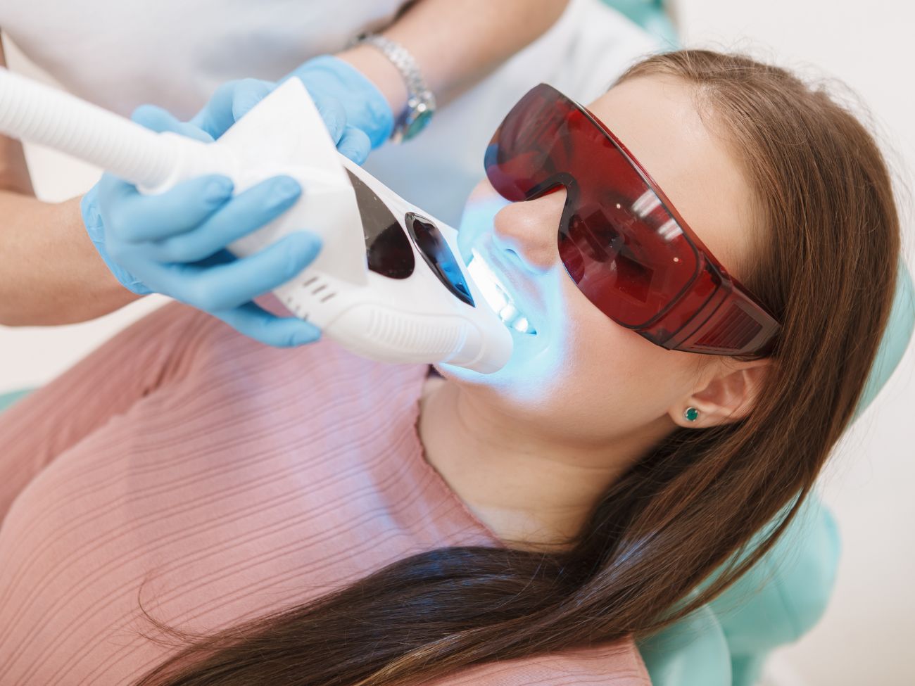Teeth whitening