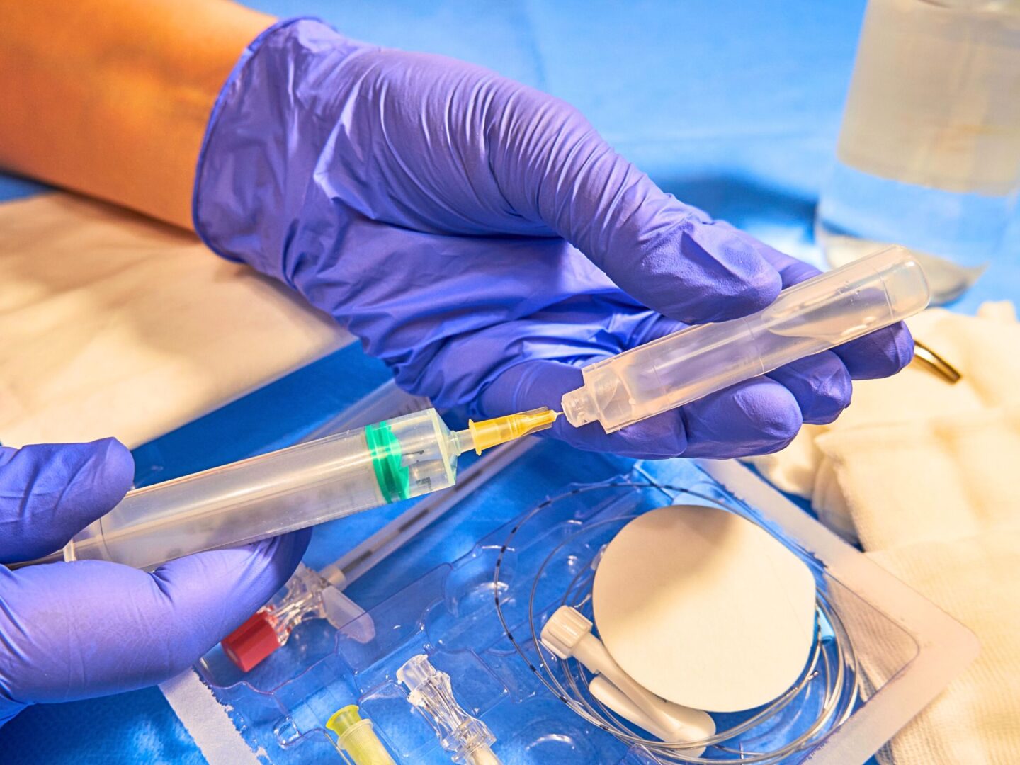 Epidural