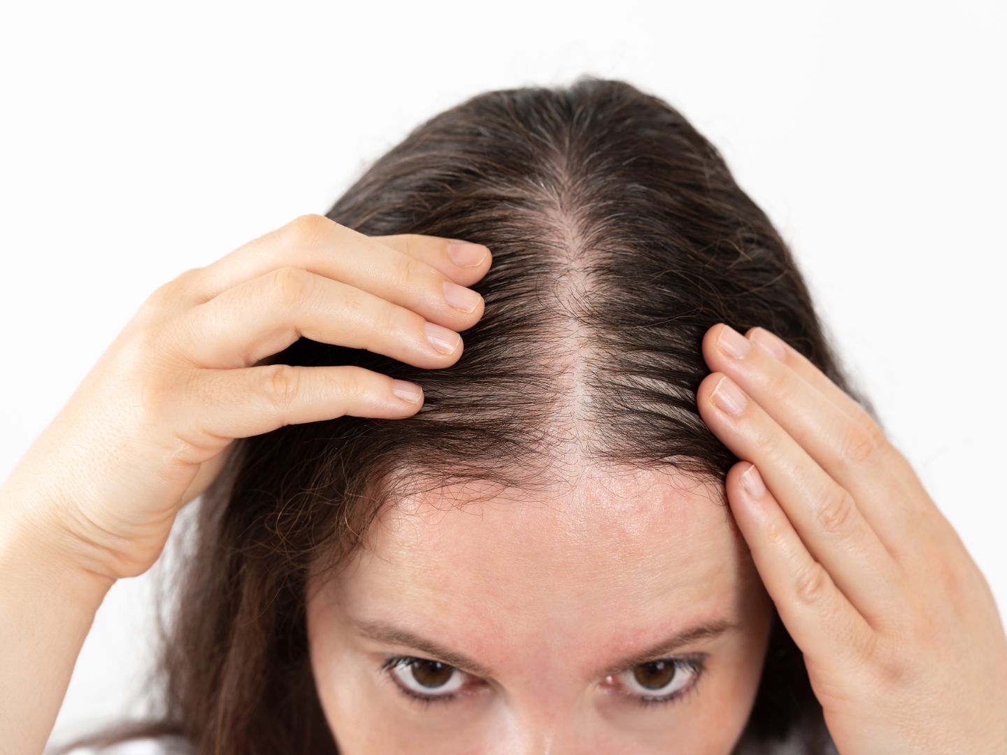 Hair loss treatment